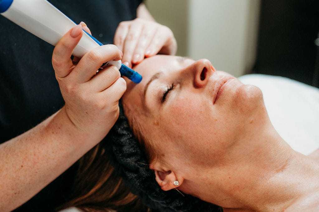 woman receiving microneedling