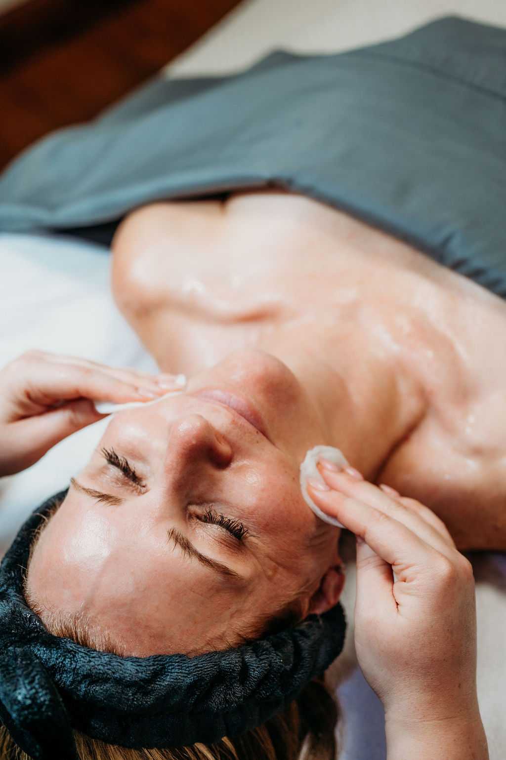 woman receiving chemical peel facial treatment